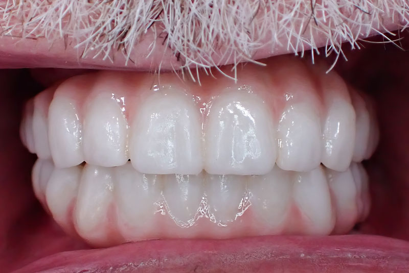 close up of before and after procedure