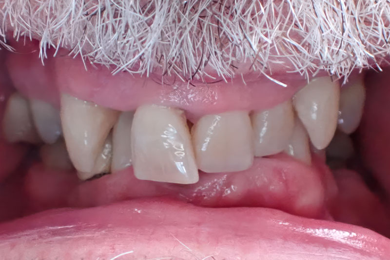 close up of before and after procedure