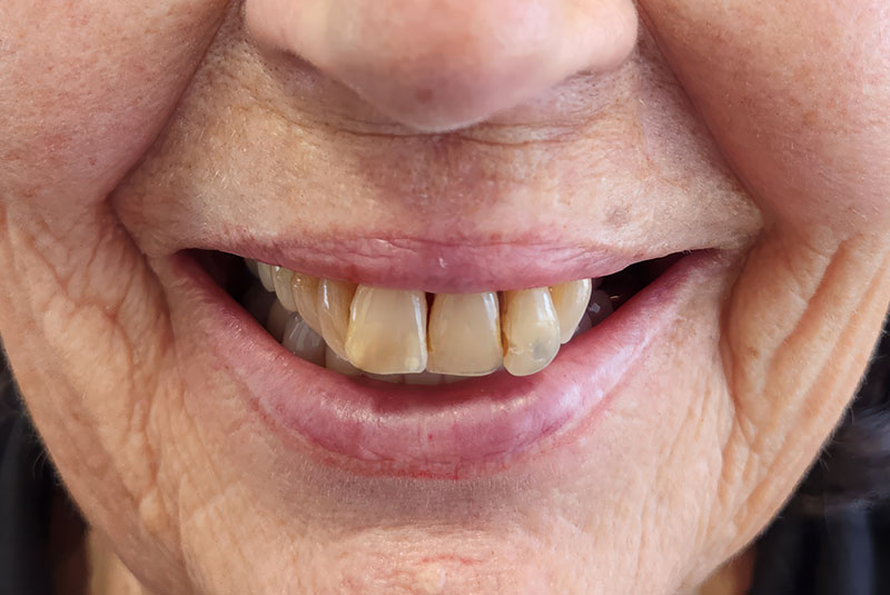 close up of before and after procedure