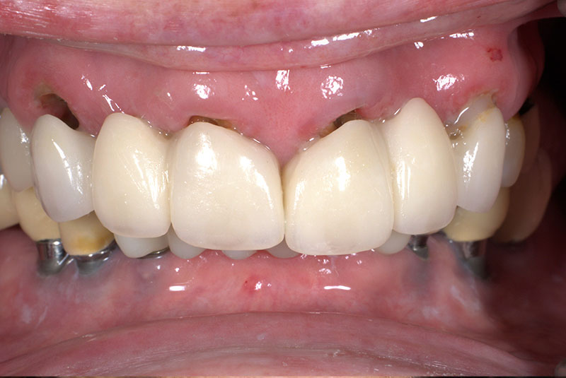 close up of before and after procedure