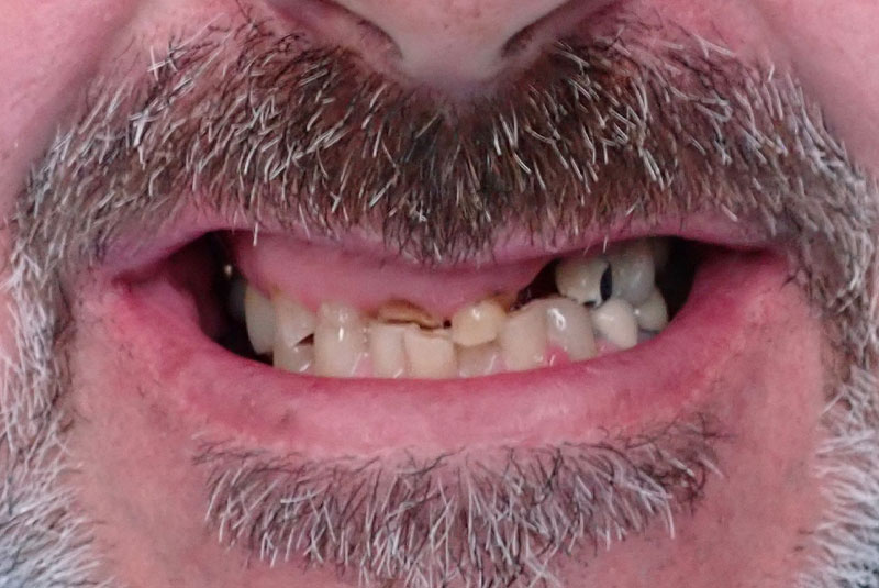 close up of before and after procedure