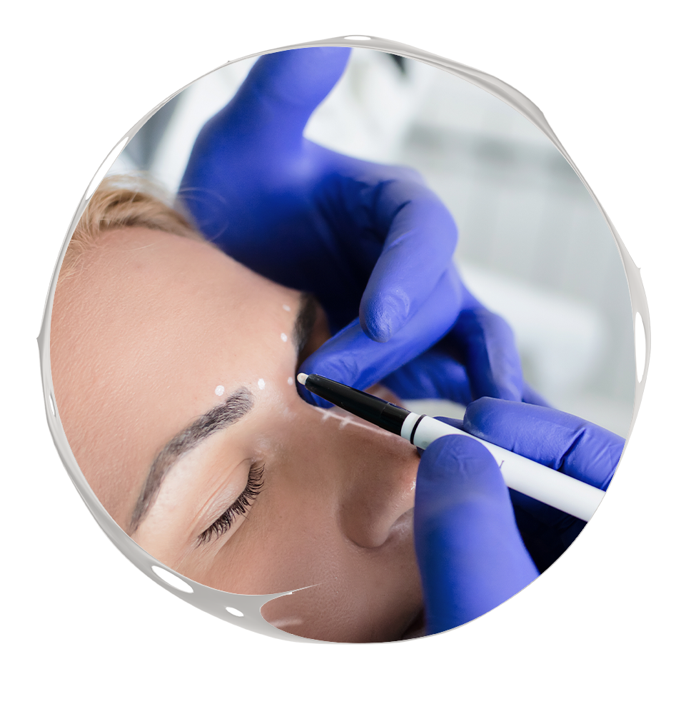 Patient getting ready for botox treatment